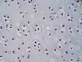Magnified cross-section of the cartilage of the trachea.