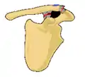Classification type 4