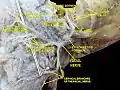 Lateral head anatomy detail. Facial nerve dissection.