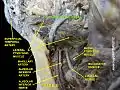 Infratemporal fossa