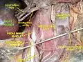 Kidney