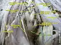 Sciatic nerve.
