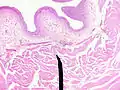 Layers of the bladder wall and cross-section of the detrusor muscle